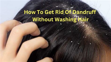 reddit poo|remove dandruff without washing hair.